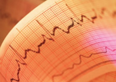 Arrhythmia Treatment